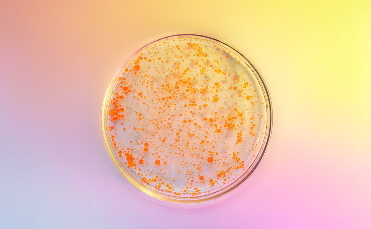 Petri dish showing bacterial growth used for testing disinfectant efficacy and hygiene standards